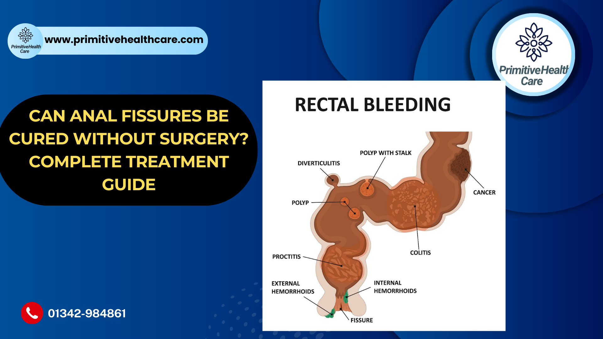 Blood From Anal During Fasting what to do